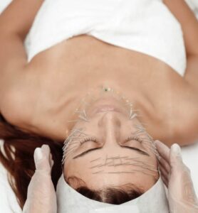 Read more about the article Co to jest Needle Shaping i dlaczego to naturalna alternatywa dla wypełniaczy?