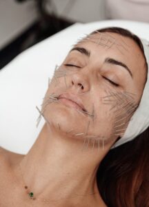 Read more about the article Przeciwwskazania do Needle Shaping – co powinieneś wiedzieć?