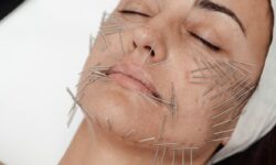 Przeciwwskazania do Needle Shaping – co powinieneś wiedzieć?