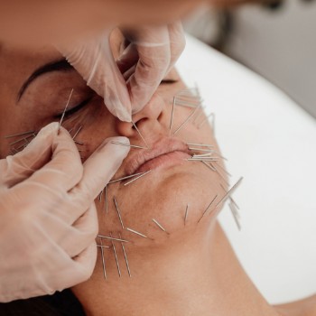 Needle Shaping